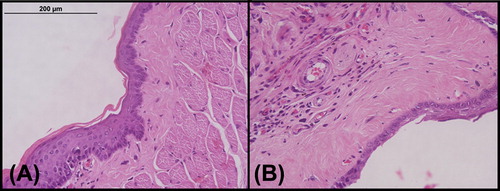 Figure 1. Light microscopy images (20×). Histological sections (10 μm) of a pouch treated with Th+ Seq-BNCT, 28 days post-treatment (hematoxylin-eosin stain). (A) Normal-looking epithelium, with areas of hyperplasia; (B) Area with abundant fibrous hyaline tissue, with a scar-like appearance, underlying the epithelium.