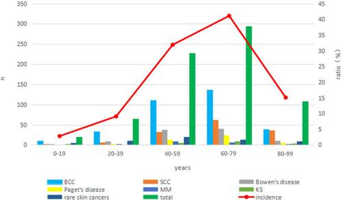 Figure 2 Age distribution of skin cancers.