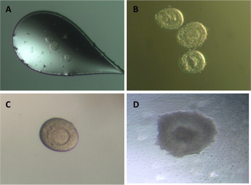 Figure 3. Vitrified and In Vitro Matured Preantral Mouse Oocytes. A) Preantral oocytes within cryoloop. B) Thawed oocytes. C) Oocyte after 2 days of in vitro maturation. D) Oocyte after 10 days of in vitro maturation.