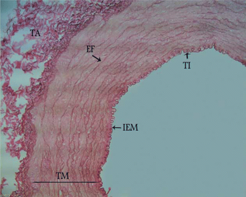 Figure 2.  Photomicrograph – canine external carotid artery transitional zone with parallel and fenestrated elastic fibres in the media. TI, tunica intima; TM, tunica media; TA, tunica adventitia; IEM, internal elastic membrane; EF, elastic fibres. Orcein stain, 280×, Bar = 35.7 µm.