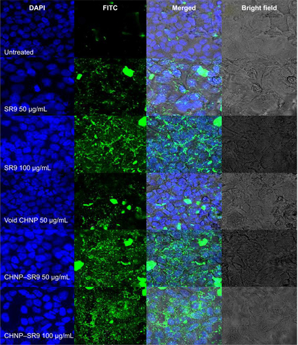 Figure S12 Confocal images showing an increase in expression of caspase-3 with SR9 treatments. Confocal microscopy was used to observe the caspase-3 expression in Caco-2 cells treated with SR9, CHNP–SR9, and void CHNP. It was observed that both SR9 (50 and 100 μg/mL) and CHNP–SR9 (50 and 100 μg/mL) showed a dose-dependent increase in expression of caspase-3, whereas little or insignificant increase was evident in caspase-3 expression or Caco-2 cells treated with void CHNP.Abbreviations: CHNP, chitosan nanoparticles; DAPI, 4′,6-diamidino-2-phenylindole; FITC, fluorescein isothiocyanate; SR9, cell-permeable dominant negative survivin SurR9-C84A; Caco-2, colorectal adenocarcinoma cells.