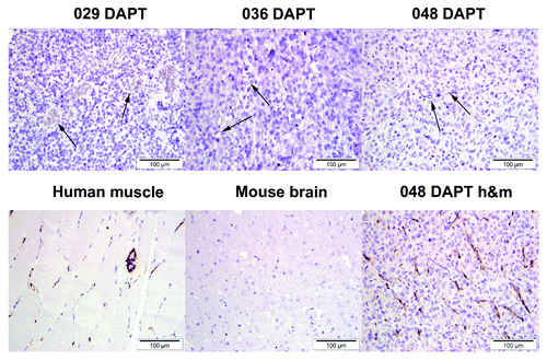 Figure 5. Intratumoral endothelial cells are not of human origin. Top row shows immunodetection of endothelial cells in tumors formed from DAPT-treated 029, 036, and 048 cells using a human-specific CD31 antibody. Arrows show negative endothelial cells. Bottom row shows immunodetection of the human-specific CD31 marker in a positive tissue control (human muscle) and a negative tissue control (mouse brain). 048 DAPT h&m is a section from the same tumor block as in the top row, but stained with a CD31 antibody detecting both human and mouse CD31.