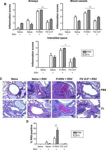 Figure 7 CL-mediated depletion of alveolar macrophages differentially modulates histopathology and mucus production.Notes: The lung tissues from mice were collected 5 days after RSV challenge. The lung tissues were fixed with 10% neutral buffered formalin solution and embedded in paraffin. (A) Histology photographs of hematoxylin and eosin staining. (B) Histopathological scores. (C) Histology photographs of PAS staining. (D) Percentages of PAS-positive area. Histopathological scores were determined in the airways, blood vessels, and interstitial spaces. PBS panel: mock (PBS)-treated groups. CL panel: CL-treated groups. Representative histology photographs from each group were taken and scale bars indicate 100 μm. The reproducible data were obtained from two independent experiments (n=3–5). Statistical significance was determined using an unpaired two-tailed Student’s t-test. Error bars indicate means ± standard error of the mean of concentration or ratios from individual animals (n=5). *P<0.05; **P<0.01.Abbreviations: CL, clodronate liposome; FG VLP, a combination of fusion and glycoprotein virus-like nanoparticles; FI-RSV, formalin-inactivated RSV; PAS, periodic acid–Schiff; PBS, phosphate-buffered saline; RSV, respiratory syncytial virus.