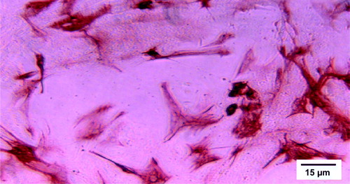 Figure 2.  Primary, desmin-positive, porcine skeletal myoblasts in culture. Visualized using anti-desmin antibody (provided by Professor Ismo Virtanen) without counterstain.