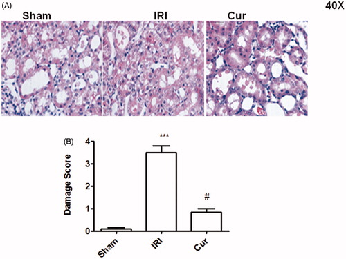 Figure 2. Effects of Curcumin pretreatment on I/R-induced renal histology. Representative microphotographs were taken from the kidneys of the sham, IRI, and Cur groups at the time point of 24 h after renal I/R. Histopathological examination was performed using PAS staining. Semi-quantitative assessment of the histological lesions based on tubular necrosis (B). Data are represented as mean ± SEM (n = 10). ***p < .001 (IRI vs. Sham); #p < .001 (IRI vs. Cur).