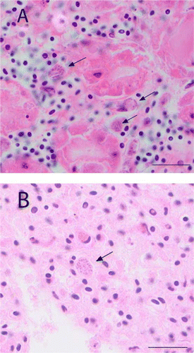 Figure 5  Photomicrographs of tissue sections from chick 86437 showing evidence of haemoparasite infection. The protozoa-like organisms can be seen as granular bodies (arrows) resembling merozoites that distend the cytoplasm. A, Enlarged kidney endothelial cells (bar = 20 µm). B, Lung endothelial cells (bar = 25 µm). (H&E stain).