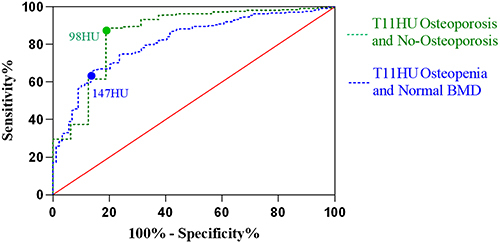 Figure 4 ROC curves for T11 HU values; the area under the curve (AUC) of the ROC line for T11 distinguishing osteoporosis from non-osteoporosis was 0.86 (95% CI 0.752–0.968), with a HU value of 98; the AUC of the ROC line for T11 distinguishing reduced versus normal bone was 0.815 (95% CI 0.766–0.865), with a HU value was 147. The threshold of T11HU values for distinguishing osteoporosis from non-osteoporosis was 98 (sensitivity 88.72%, specificity 81.25%). Threshold for distinguishing osteopenia from normal BMD is 147 (sensitivity 66.53%, specificity 85.39%). When T11HU scores was <98, 13 patients with osteoporosis were found in 50 patients; when T11HU scores was >147, 158 of 173 patients had normal BMD.