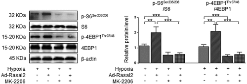 Figure 5. Rasal2-mediated phosphorylation of S6 and 4EBP1 in hypoxia-challenged PASMC was abolished by AKT inhibition. PASMC was firstly treated with MK2206 (1 μM) or equivalent vehicle for 6 h. Then, cells were transfected with Ad-Rasal2 or Ad-Con and cultured under normal/hypoxic conditions for another 24 h. Images of immunoblotting and normalized expression levels of p-S6Ser235/236, S6, p-4EBP1Thr37/46, 4EBP1 and β-actin in PASMC are shown (n = 4). Data are expressed as mean ± SD. ** and *** indicates a significant difference of P < 0.01 and P < 0.001 between the two marked groups, respectively.