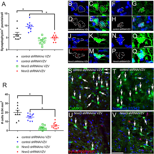 Figure 5 Synaptophysin and CaMKII expression in the lateral parabrachial nucleus. In these rats the central amygdala was infused with virus expressing a scrambled shRNA or a Nrxn3 shRNA. The central amygdala of Gad1-iCre Long Evans rats was infused with AAV1 containing pAAV hSyn FLEx mGFP-2A-Synaptophysin-mRuby. Excitable cells within the lateral parabrachial nucleus were labeled by infusing this nucleus with AAV5 virus containing pAAV-CaMKIIa-EGFP. After four weeks post-surgery the whisker pad of the infused rats were injected with MeWo cells without varicella zoster virus (no VZV) or MeWo cells containing VZV. Two weeks after injection the brain was isolated and imaged. (A) shows the average number of synaptophysin terminals or puncta localized to each CaMKII positive cell within the lateral parabrachial nucleus. Representative images of rats treated with control shRNA/no VZV (B–E) or control shRNA/VZV (F–I) or Nrxn3 shRNA/no VZV (J–M) or Nrxn3 shRNA/VZV (N–Q) are shown. Hoechst 33342 nuclear stain (B, F, J and N) and CaMKII stain (C, G, K and O) and synaptophysin stain (D, H, L and P) is represented in several cells . Individual CaMKII positive cells (green) are outlined with a white dotted line. Arrows point to synaptophysin positive puncta (red, D, H, L and P) colocalizing with CaMKII staining (E, I, M and Q). Bar = 10 µm. Panel R shows the number of CaMKII positive cells in the lateral parabrachial nucleus that colocalized with synaptophysin. Each point is from an individual animal in panels A and R. An asterisk indicates a significant difference of α=0.05. Representative images of rats treated with control shRNA/no VZV (S) or control shRNA/VZV (T) or Nrxn3 shRNA/no VZV (U) or Nrxn3 shRNA/VZV (V) show cells with synaptophysin stain colocalizing with CaMKII stain (yellow, arrows). Bar = 50 µm.