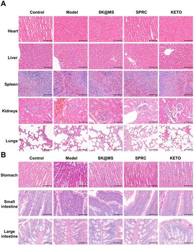 Figure 6 Evaluation of potential adverse effects of supplementations in experimental rats. H&E staining was carried out for the examination of (A) heart, liver, spleen, kidneys, lungs, (B) and stomach, small intestine, large intestine after 30 days’ experiment (scale bar = 100 μm).