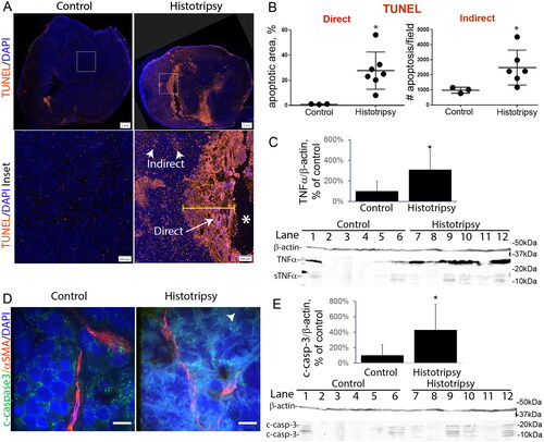 Figure 2. Histotripsy induces fractionation and apoptosis directly as well as via TNFα 24 h after treatment. A) Representative images of the apoptosis marker TUNEL in controls (left panels) and histrotripsy-treated tumors (right panels), shown at low magnification (top row, bar = 1mm) or high magnification of white box (bottom row, bar = 200µm). Histotripsy resulted in a fractionated area devoid of nuclei denoted by *, bottom right panel), and surrounded by a rim of TUNEL-positive cells ‘Direct effect’. Tumor regions distant from the ablation site also had more TUNEL-positive cells (labeled ‘Indirect effect’) than controls. B) Direct apoptosis (areas adjacent to fractionation) was 28% higher in histotripsy (p < 0.0001). Apoptosis also increased 2.5-fold in Indirect areas (p = 0.02). C) SDS-PAGE of untreated controls vs histrotripsy-treated tumors under denaturing conditions reveals that histotripsy induced a four-fold increase in TNFα relative to controls, both full-length (25 kDa) as well as soluble forms (17 kDa) (lanes 1-6 are control tumors; lanes 7-12 are histrotripsy-treated tumors); graph quantifies both forms normalized to β-actin housekeeping gene as a % of controls (p < 0.05, n = 6 per group). D) Representative sections of c-casp-3 (green) in control or histotripsy-treated tumors: histotripsy increased c-casp-3 in tumor cells within Indirect areas (arrowhead). E) SDS-PAGE of tumor protein extracts revealed that histotripsy induced a four-fold increase in c-casp-3 (19 kDa) compared to controls (p < 0.05, n = 6 per group) (Lanes 1-6 are control tumors; lanes 7-12 are histrotripsy-treated tumors) Graph quantifies c-casp-3 normalized to beta actin housekeeping gene as a % of controls. *=p < 0.05. All graphs represent means and standard deviation.