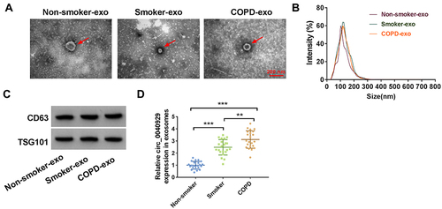 Figure 7 Serum exosomal circ_0040929 is upregulated in COPD patients. (A) Representative images of exosomes from non-smokers, smokers, and COPD patient serum were presented by TEM. (B) Size distribution of exosomes were analyzed by NTA. (C) The markers of exosome (CD63 and TSG101) were detected by Western blot assay in exosomes from non-smokers, smokers, and COPD patient serum (n=3). (D) The expression of circ_0040929 was examined by qRT-PCR in serum exosomes from non-smokers (n=22), smokers (n=22), and COPD patients (n=22). **P<0.01, ***P<0.001.