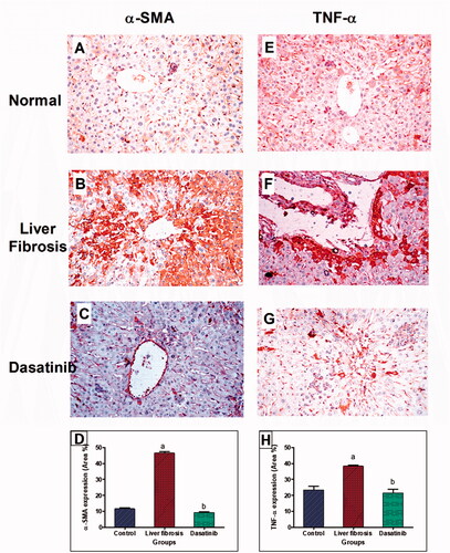 Figure 4. Immunostaining of α-smooth muscle actin (α-SMA) and tumour necrosis factor-α (TNF-α) in the liver tissue of mice with thioacetamide-induced liver fibrosis (H&E × 40). (A) α-SMA/control group, (B) α-SMA/liver fibrosis group, (C) α-SMA/dasatinib-treated group, (E) TNF-α/control group, (F) TNF-α/liver fibrosis group, (G) TNF-α/dasatinib-treated group, (D, H) represent a comparative quantification of the immunohistochemical expression for α-SMA and TNF-α in hepatic tissue of mice from all groups: The severity of the immunoactivity is depending on the intensity and distribution of the brown colour. aRepresents a significant difference from the normal control group, ba significant difference from liver fibrosis inducted-group (at p ˂ .05).