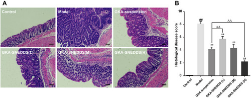 Figure 4 (A) Representative H&E staining histological sections showing inflammatory changes in the colon. Scales bar, 100μm. (B) Histological disease score. The results were expressed as mean ± SD. ##p < 0.01 compared with the control group, **p < 0.01 compared with the model group, ΔΔp < 0.01 compared with the GKA-suspension-treated group.