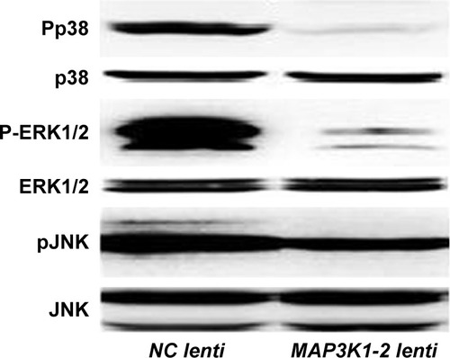 Figure 8 Western blot analysis of p38, ERK1/2, and JNK, and phosphorylation of p38, ERK1/2, and JNK in MKN45 cells with or without lentivirus transfection. Expression level of phosphorylation decreased in MKN45 with MAP3K1-2 lenti transfection. Data are representative of results from three other experiments.
