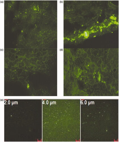 Figure 5. Fluorescent microscopic images of microtome sections of rat lung (a) 10 min, (b) 6 h, (c) 24 h, (d) 48 h post-IV administration of FITC-dextran loaded Alb MS and (e) confocal microscopic images of rat lung at various depths, 30 min post-IV administration of FITC-dextran loaded Alb MS. Magnification ×200.