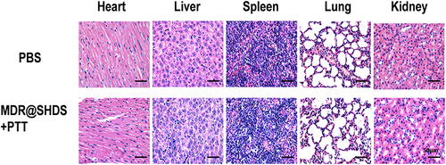 Figure 13 H&E staining of mice heart, liver, spleen, lung, and kidney after PBS and MDR@SHDS treatments.