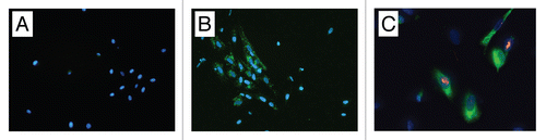 Figure 4 Fluorescence microscopy of cultures obtained from wound digests. (A) Murine cells derived from digestion of control defects, no presence of PKH67. (B) Populations of PKH-67-stained HUCPVCs were identified alongside murine-derived cells following digestion of treatment defects. Intact DAPI-stained nuclei indicate viable cells. (C) Immunocytochemical analysis for Ki-67 (red, visualized using Texas red) colocalized to DAPI-stained cell nuclei of PKH67-positive (green) HUCPVCs. Field widths: (A and B) 29 µm, (C) 214 µm.