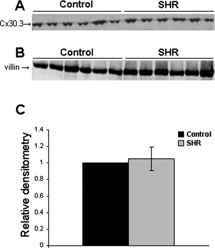 Figure 7 Immunoblotting analysis of Cx30.3 expression in the kidneys of normotensive (Sprague-Dawley, control) and hypertensive (SHR) rats. (A) A representative blot of control and SHR samples probed with Cx30.3. (B) The same blot probed with villin antibodies to demonstrate even loading. Specific bands for Cx30.3 and villin were detected around 37 and 92 kDa, respectively. (C) Densitometric analysis of Cx30.3 expression. No statistically significant difference in Cx30.3 expression was observed between the two groups (p = 0.85). Shown is mean ± SE of six rats per experimental group.