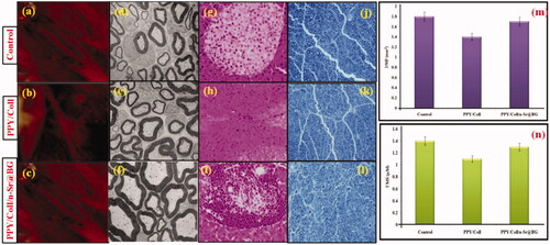 Figure 5. (a–c) Intraoperative photographs of samples 24 weeks postoperatively of all rats group. (d–f) TEM images of regenerated axons and myelin sheath. (g–i) Rejuvenated sciatic nerve stained with H&E staining in different groups at 24 weeks postoperation. (j–l) Rejuvenated sciatic nerve stained with MB staining in different groups at 24 weeks postoperation. (m) The density of myelinated fibres and (n) thickness of myelin sheath in all groups rats.