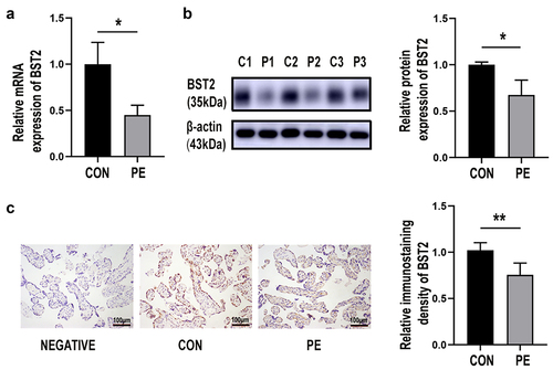 Figure 1. BST2 was decreased in the placental tissue of preeclampsia patients. (a) The mRNA expression level of BST2 in the placental tissues of preeclamptic patients (PE) and normal controls (CON) was determined using qRT-PCR, CON = 16, PE = 24. (b) Representative western blotting image of BST2 in placental tissue samples and quantification of its expression normalized to β-actin in placentas. (CON: C1, C2, C3; PE: P1, P2, P3). (c) Representative images from immunohistochemical analysis of BST2 expression in human placentas (under preeclampsia and not). Original magnification: × 200; Scale bar: 100 μm. Data are shown as the mean ± SD from three independent experiments. Statistical significance was calculated by Student’s t test. *p< 0.05, **p< 0.01.