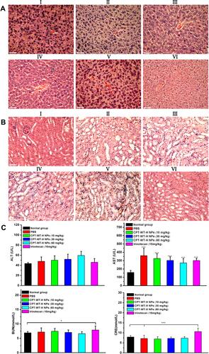 Figure 6 Representative H&E-stained histological images obtained from liver (A) and kidneys (B) after intravenous administration of irinotecan (10 mg·kg−1) and CPT-WT-H NPs (10, 30, 60 mg·kg−1). The PBS-treated group and the untreated group were used as the control. (I: PBS, II: CPT-WT-H NPs (10mg·kg−1), III: CPT-WT-H NPs (30mg·kg−1), IV: CPT-WT-H NPs (60mg·kg−1), V: Irinotecan (10 mg·kg−1), VI: Normal group). (C) Blood biochemical analysis of after the antitumor efficacy evaluation. The PBS-treated group and the untreated group were used as the control. The main parameters of hepatic and renal function are alanine transaminase (ALT), aspartate transaminase (AST), blood urea nitrogen (BUN), and creatinine (CRE). Error bars indicate SD (n = 6). *p < 0.05; ***p < 0.001.