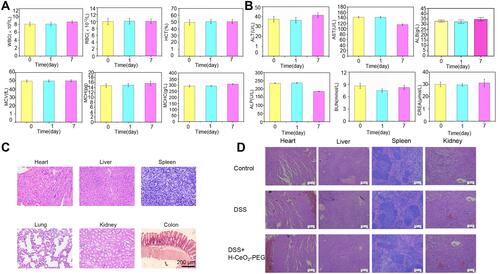 Figure 8 In vivo toxicology evaluation of H-CeO2-PEG. (A) Hematological indicators. (B) Blood biochemistry indicators. (C) H&E stained images of tissue from the heart, liver, spleen, lung, kidneys and colon from the healthy mice. (D) H&E stained images of organs from the mice after different treatment.