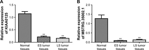 Figure 4 qPCR confirmed the differential expression of (A) KIAA0125 and (B) MSTRG.35002.1 in ES and LS colon tumor tissues compared with that in normal tissues. Data are presented as the mean ± SD. **P<0.01 compared with normal tissues.Abbreviations: qPCR, quantitative PCR; ES, early stage; LS, late stage.