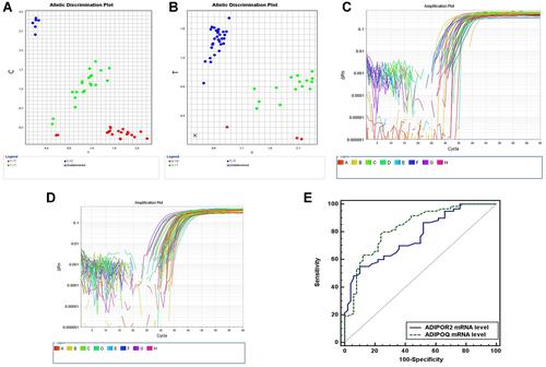 Figure 1 (A) Allele discrimination plot of ADIPOR2 rs 10773989 T>C where homozygous T were colored in red and homozygous C were colored in blue and heterozygous TC were colored green. (B) Allele discrimination plot of ADIPOQ rs2241766 T>G where homozygous T were colored in blue and homozygous G were colored in red and heterozygous GT were colored green. (C) Amplification plot of ADIPOR2 mRNA. (D) Amplification plot of ADIPOQ mRNA. (E) ROC curve demonstrating sensitivity and specificity of both ADIPOQ and ADIPOR2 mRNA levels.