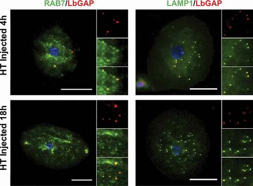 Figure 4. LbGAP co-immunolocalizes with endolysosomal compartments in Drosophila lamellocytes. Merged pictures of HopTum-l (HT) lamellocytes 4 h and 18 h after injection of larvae with venosomes, fixation and immunostaining with an anti-LbGAP antibody (red) and either anti-Rab7 or anti-Lamp1 antibodies (Green) (the inserts show individual fluorescence channel and the merged image for selected areas). The yellow/orange spots on the merged pictures indicate a co-immunolocalization. Nuclei are stained with DAPI (blue). Bars, 20 µm