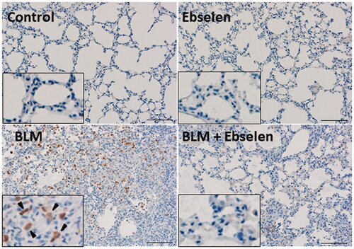 Figure 8. Analysis of TGF-β expression by immunohistochemistry. Immunohistochemical analysis of TGF-β expression in mouse lung. Many TGF-β positive cells were observed in BLM treated mice lungs (arrowheads), whereas few TGF-β positive cells were observed in BLM and ebselen treated mouse lungs. BLM: bleomycin; TGF-β1: transforming growth factor-β1.
