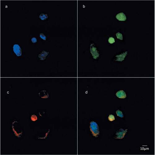 Figure 3. Choline containing lipids synthesized as the cells transverse mitosis colocalize with ER membrane marker. HeLa cells, synchronized by 2TB and released for 8 h, were incubated with 2 mM prop-Cho for 2 h. The cells were fixed and processed for immunofluorescence with Alexa 488-azide (b) and Alexa 647-conjugated concanavalin A (c) and analyzed by confocal microscopy (Olympus FV1000 microscope). (a) Hoechst staining; (d) merged.