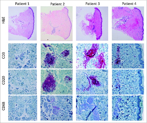 Figure 1. Histology and immunohistochemistry.