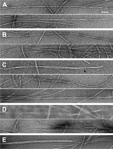 Figure 6 Structural variability of HET-s PFD pH 2 fibers with multiple single fibrils.Notes: (A) Triplet fibers in which three 5 nm single fibrils are supercoiled, giving a fibril with an approximately uniform diameter (9–10 nm) and an axial repeat of 120 nm (3×40 nm, the spacing between crossovers), ~70% of total. The bar represents 50 nm. (B) Triplet fibers with a ribbon-like arrangement of three 5 nm single fibrils (~10% of total). These fibers vary in width from ~4.5 nm at the thinnest parts (=crossovers) to ~14 nm at the thickest parts where the three component single fibrils are resolved in many cases. The inter-crossover spacing ranges from ~130 nm for most fibers of this kind and up to ~600 nm in extreme cases. (C) Paired triplet fibers (~15% of total) with diameters of ~18 nm at the thickest parts and ~9 nm at the crossovers. The inter-crossover spacing is ~100 nm in most cases. Arrowhead marks a transition point at which one triplet fiber ends and only the other one continues. (D) Fiber with six 5 nm single fibrils arranged in a ribbon (~4% of total) varies from ~25 nm in width at the thick parts and ~5 nm at the crossovers, with axial repeat lengths between 150 and 300 nm. (E) Compact fiber with possibly six or more single fibrils (~1% of total). Their diameter is a relatively constant between 17 and 22 nm. The number of elementary fibrils inferred to be present in these various kinds of pH 2 fibers is based on mass-per-unit-length measurements using scanning transmission electron microscopy, as well as negative staining EM. Adapted from Journal of Molecular Biology, 370(4), Sabate R, Baxa U, Benkemoun L, et al, Prion and non-prion amyloids of the HET-s prion forming domain, 768–783, Copyright © 2007, with permission from Elsevier.Citation32Abbreviations: EM, electron microscopy; HET-s PFD, HET-s prion-forming domain.