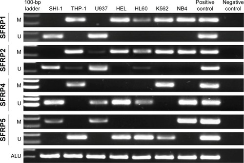 Figure 1 Electrophoresis results of RQ-MSP products in leukemic cell lines.