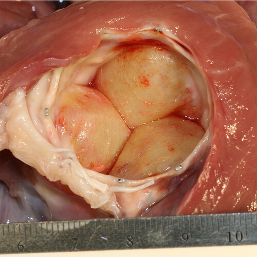 Figure 5. Photograph of the TAVR device healed into the modified annulus in a Test group animal at 140 day gross examination.