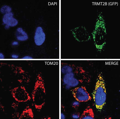 Figure 2. TRMT2B is localized to mitochondria.TRMT2B-GFP cDNA construct transfected into HeLa cells and detected by fluorescence (top right, green). Nuclei were stained using DAPI (top left, blue). The mitochondrial network was stained using antibodies against the known mitochondrial protein TOM20 (bottom left, red). Colocalisation of TRMT2B and TOM20 appears as yellow in a digitally overlaid image (bottom right).
