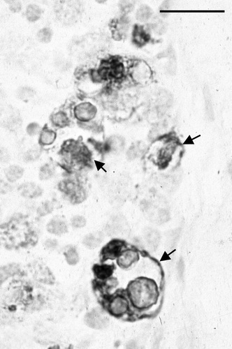Figure 6.  Large IPX-stained structures whose exact nature was not determined (arrows). Day 15 p.i., bird inoculated when 3 weeks of age. Bar = 30 µm.