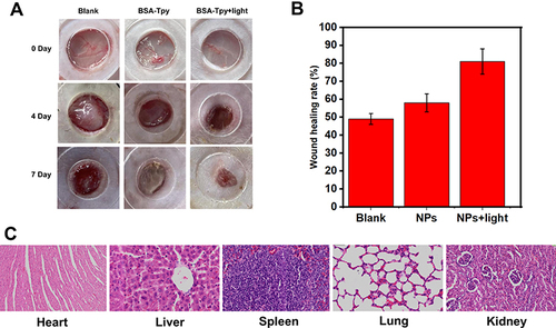 Figure 6 The evaluation of BSA-TpyNPs in treatment of bacteria-infected wounds of rats in vivo. (A) Images of MRSA-infected wounds after dealing with NPs with/without light ((50 mW·cm-2) on day 0 and day 4 postinfection. (B) The wounding healing rate of the MRSA-infected wound area on day 4 after the injury. (C) H&E staining of the organs in rats after treatment for 4 days.