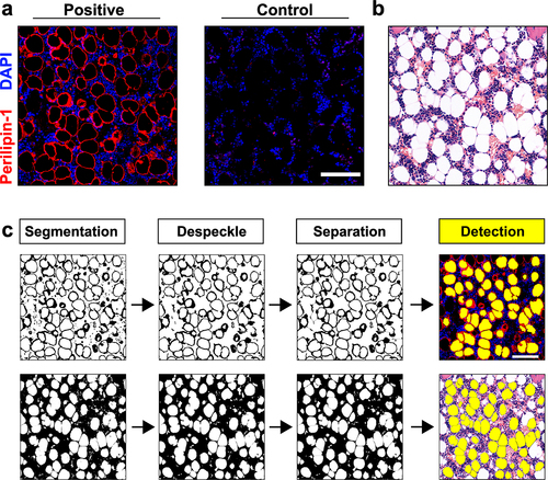 Figure 1. Semi-automated quantitation of bone marrow adipocytes in histological bone sections. (a) BMAds are positive for PLIN1. (b) In HE-stained sections, BMAds are identified as circular/oval empty regions known as ‘ghost adipocytes’. (c) The detection and quantitation script in (a) and (b) starts by segmenting, de-speckling and separating the adipocyte object from the images. The script detected 55 and 59 BMAds per field in PLIN1- and HE-stained samples shown in (c), respectively. Scale bar in (a) and (c): 100 μm.