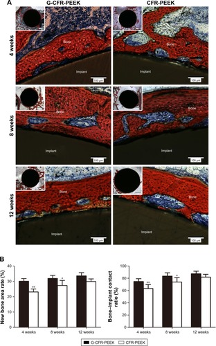 Figure 11 (A) Light microscopy showing Van Gieson staining of pathological sections of G-CFR-PEEK and CFR-PEEK scaffolds at 4, 8, and 12 weeks. Tissue stained in red indicates newly formed bone; tissue stained in dark blue indicates fibroblasts. (B) The new bone area rate and bone-implant contact ratio were analyzed from the images shown in A. Results presented as means ± SD. *P<0.05; **P<0.01.Abbreviations: CFR-PEEK, carbon fiber-reinforced polyether ether ketone; G-CFR-PEEK, graphene-modified carbon fiber-reinforced polyether ether ketone.