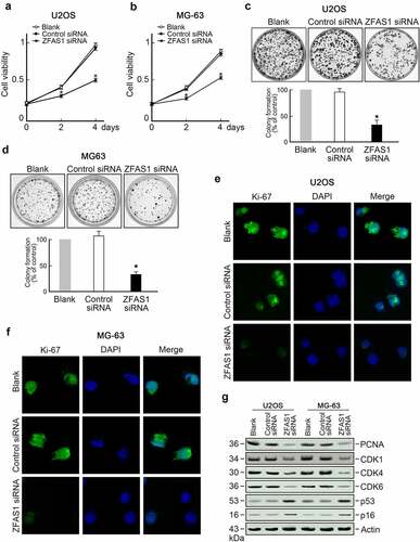 Figure 3. Knockdown of ZFAS1 inhibits osteosarcoma cells proliferation.