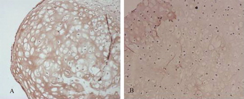 Figure 10.  Collagen type II immunohistochemistry of some specimens cultured in vitro for 8 weeks. A: co-culture group; B: Chondrocyte group.