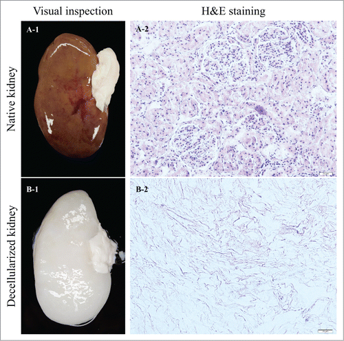 Figure 1. Native (A-1) and decellularized (B-1) porcine kidneys. Cells are visible in the native renal ECM (A-2). H&E staining confirmed complete cell removal from the decellularized ECM (B-2).