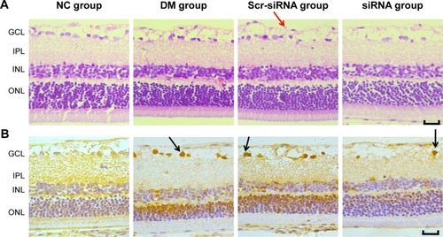 Figure 2 siRNA HMGB1 significantly inhibited retinal damage and ameliorated retina-function degeneration in vivo.