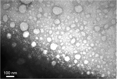 Figure 2 TEM image of the polyplex of the plasmid with (T:S)520 μM:PEI formulation.Notes: The cationic vesicles comprise (520 μM of each of them) and polyethylenimine (4.3 μg/mL). There are two particle forms, micelle like (smaller vesicles) and niosome or polymersome like (larger vesicles). Scale bar is 100 nm.Abbreviations: PEI, polyethyleneimine; S, squalene; T, Tween 80; TEM, transmission electron microscopy.