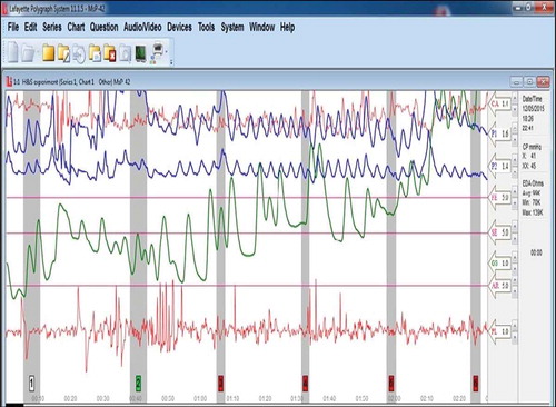 Figure 1. Digital polygraph output.Note: All pictures are of the Lafayette LX5000 and relating software. Credit to Anita Fumagalli for all pictures.