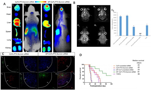 Figure 4 (A) In vivo fluorescence imaging of intracranial U251-CD133+ glioma tumor-bearing nude mice treated for 24 h with CLPs–PTX–survivin siRNA (B1) or DP-CLPs–PTX–survivin siRNA (D1) liposomes, as well as corresponding dissected organs (A1 and C1). (B) Lesions in nude mice implanted in situ with U251-CD133+ cells after treatment with CLPs–scrambled siRNA (A1), CLPs–PTX–survivin siRNA (C1), DP-CLPs–scrambled siRNA (B1) or DP-CLPs–PTX–survivin siRNA (D1); all lesions were characterized by MRI at 19 days post-injection. U251-CD133+ cells were intracranially implanted in nude mice after 48 h treatment with Taxol, CLPs–PTX–survivin siRNA or DP-CLPs–PTX–survivin siRNA. Tumor size was measured 19 days post-injection (n = 5/group). **p < .01 versus control, ###p < .001 versus the CLPs–PTX–survivin siRNA group (E1). (C) Evaluation of apoptosis in the brains of intracranial U251-CD133+ glioma tumor-bearing nude mice treated with CLPs–PTX–survivin siRNA (A1–D1) or DP-CLPs–PTX–survivin siRNA (E1–F1) at 48 h post-administration 2 days after intravenous administration. Images were obtained using an Annexin V-FITC Apoptosis Detection Kit. Image D1 is the merge of images A1, B1 and C1; image F1 is the merge of E1, F1 and G1. Green: apoptotic cells. Red: CD133. Blue: cell nuclei. White line: glioma border. White arrow: glioma direction. Original magnification: ×100. (D) Survival curve of U251-CD133+ glioma tumor-bearing nude mice.
