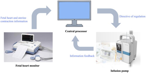 Figure 3. Principle of the OT intelligent control system during delivery.