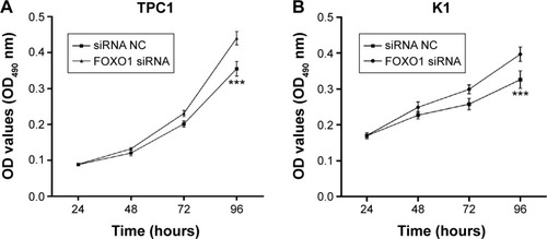 Figure 3 Knockdown of FOXO1 promoted proliferation of PTC cells.